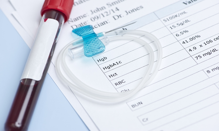 การตรวจค่าเฉลี่ยน้ำตาลในเลือด หรือ Hemoglobin A1C คือ อะไร สำคัญอย่างไร