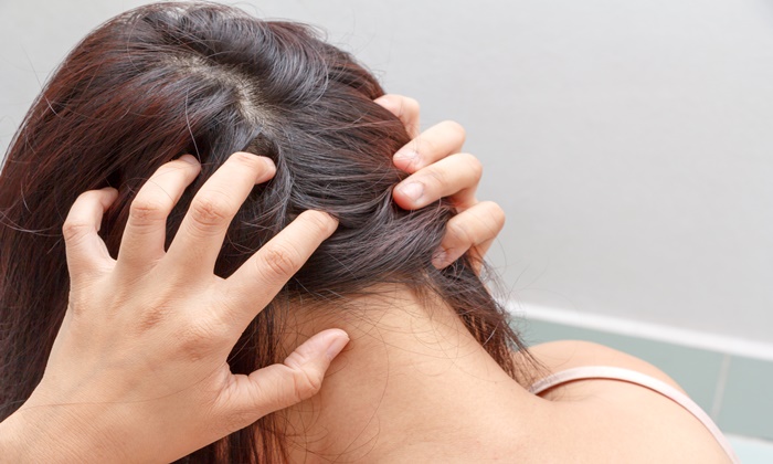 เซ็บเดิร์ม หนังศีรษะ เกิดจากสาเหตุใด รักษาได้อย่างไร