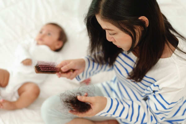 ‘ผมร่วงหลังคลอด’ ปัญหากวนใจคุณแม่ แต่รับมือได้!