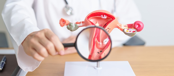 ลดน้ำหนัก-pcos-ทำไมถึงทำให้อ้วนง่าย